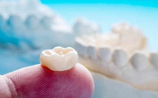 Metal free dental crown on dentist's fingertip