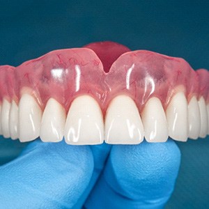 Implant Denture from Monroe, LA