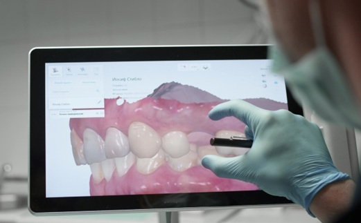 close-up of intraoral scan