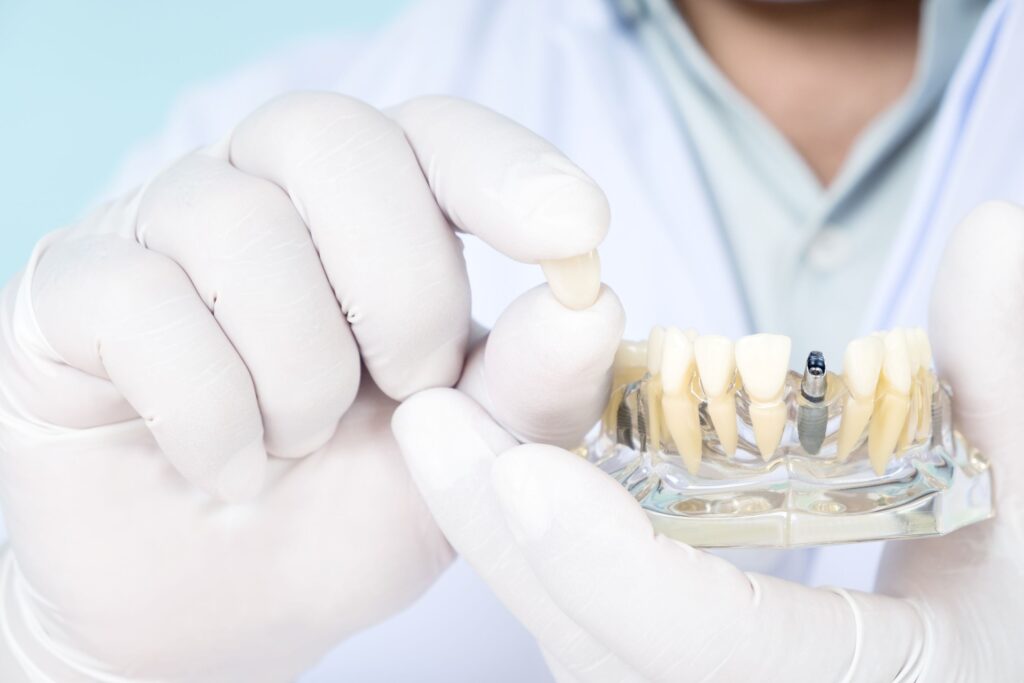 White-gloved hands holding dental crown and clear model jaw with dental implant